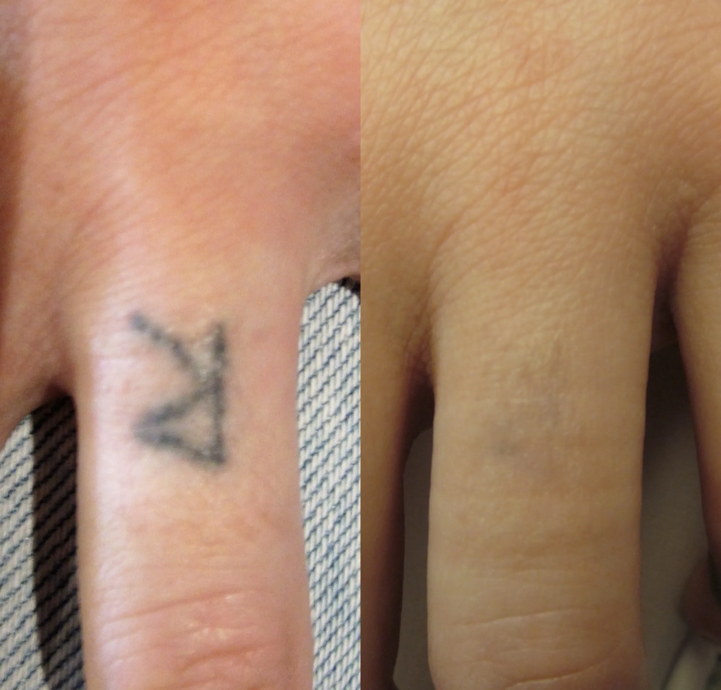 Neatcell tattoo pen review