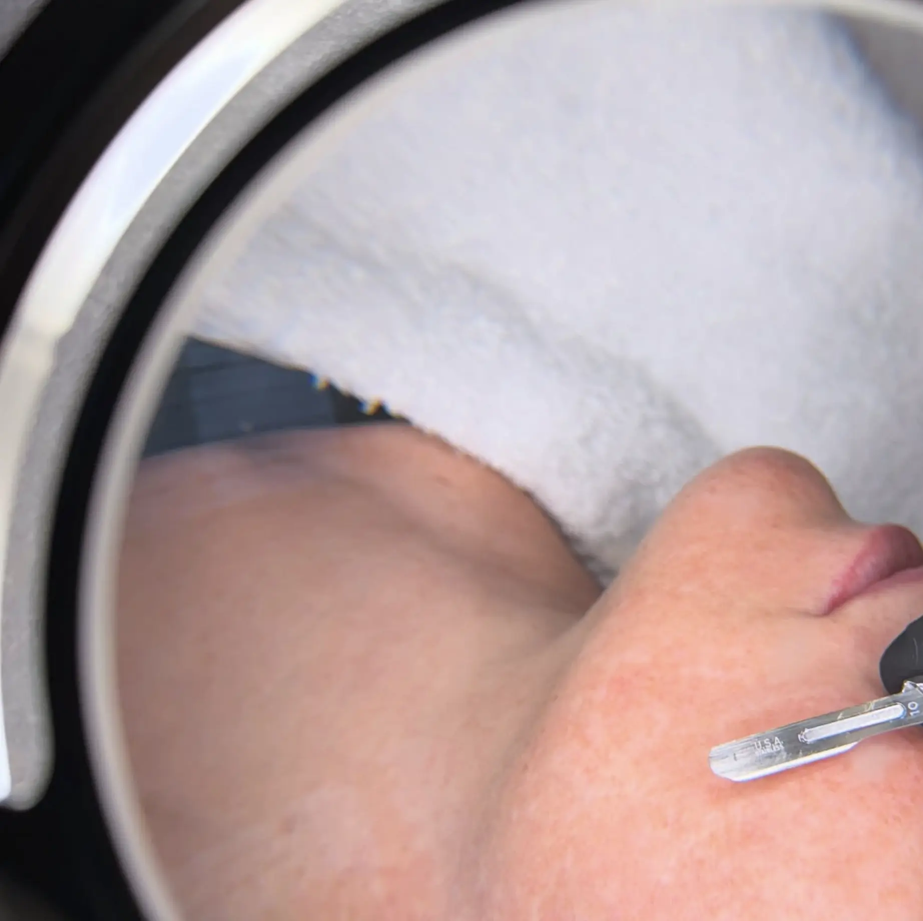 post-dermaplane aftercare