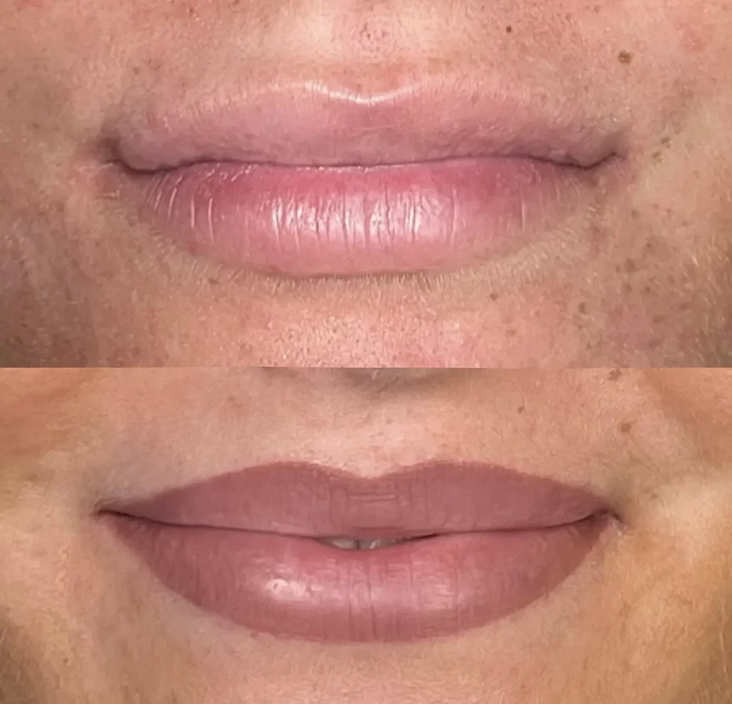 Climate Challenges Your Lips Face In Melbourne